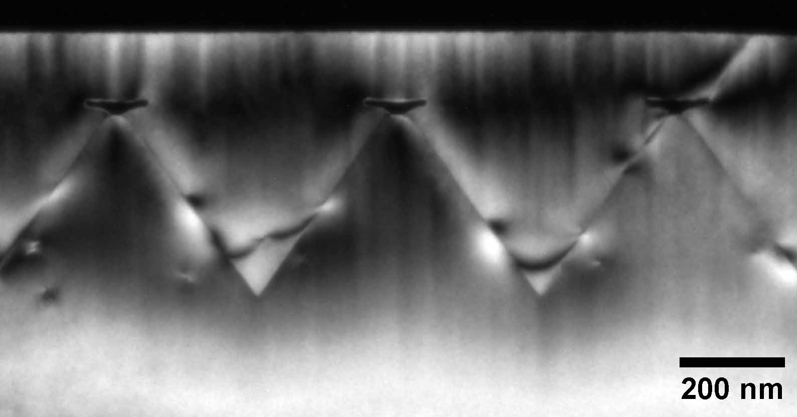 tem-ctem1 X-ray image