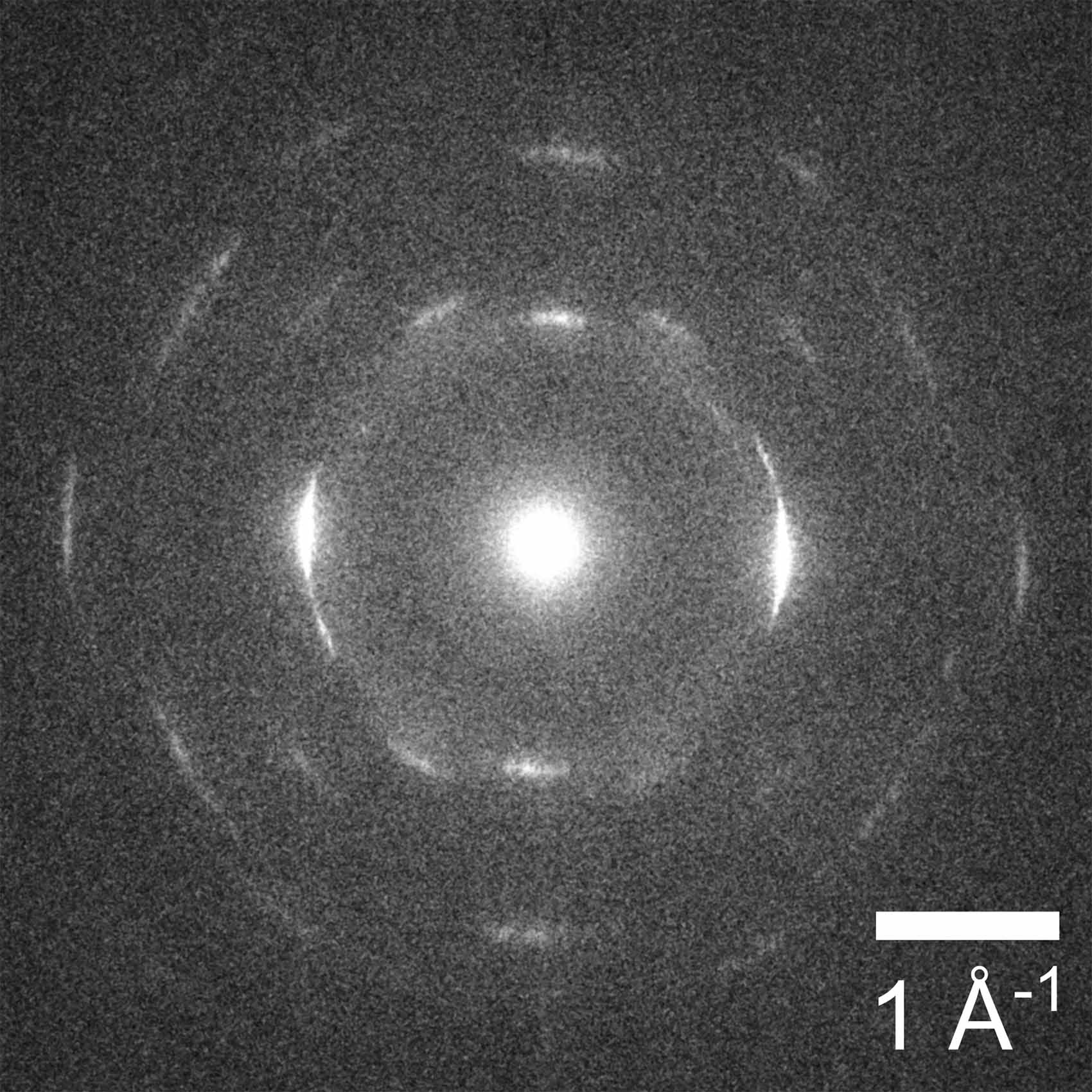 tem-ctem2 X-ray image