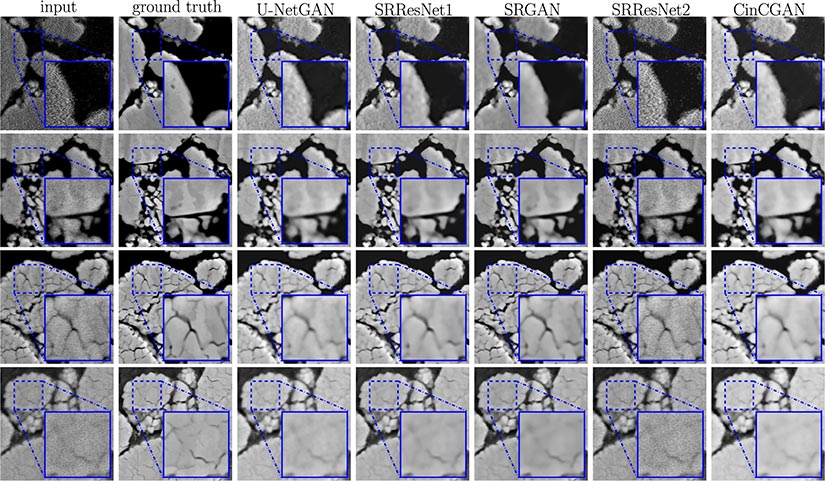 A grid of microscopy images that provide a visual comparison of super-resolution results obtained by U-NetGAN, SRResNet1, SRGAN, SRResNet2, and CinCGAN.