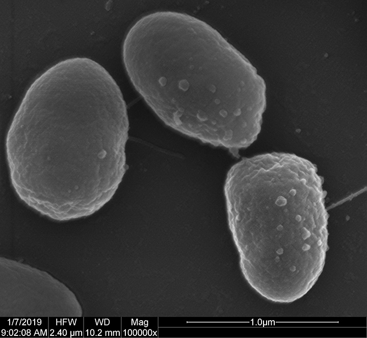 Electron microscopy image of three spherical blebs on the surface of a bacteria cell.