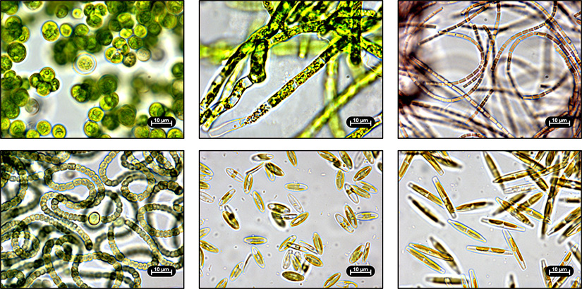 Six microscopic images of algae species